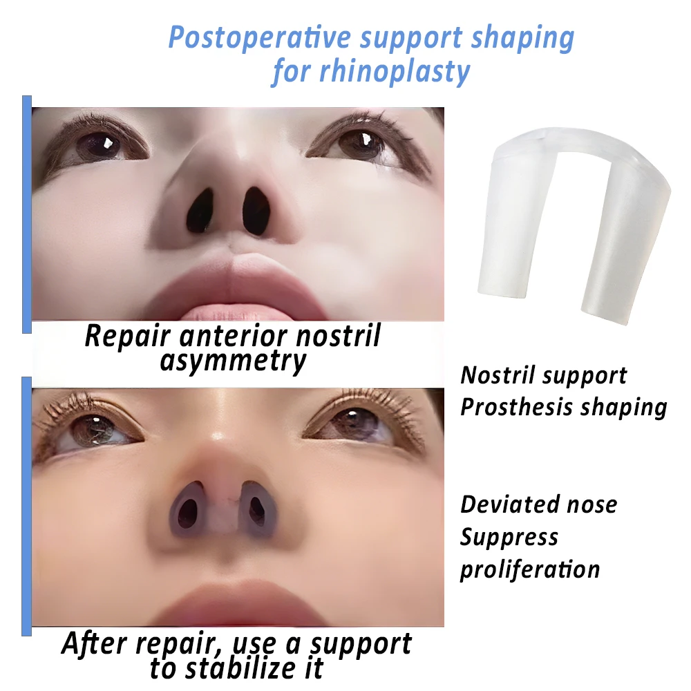 Postoperative Rhinoplasty Nost - Anti Snore Contour Pillow 评论和价格