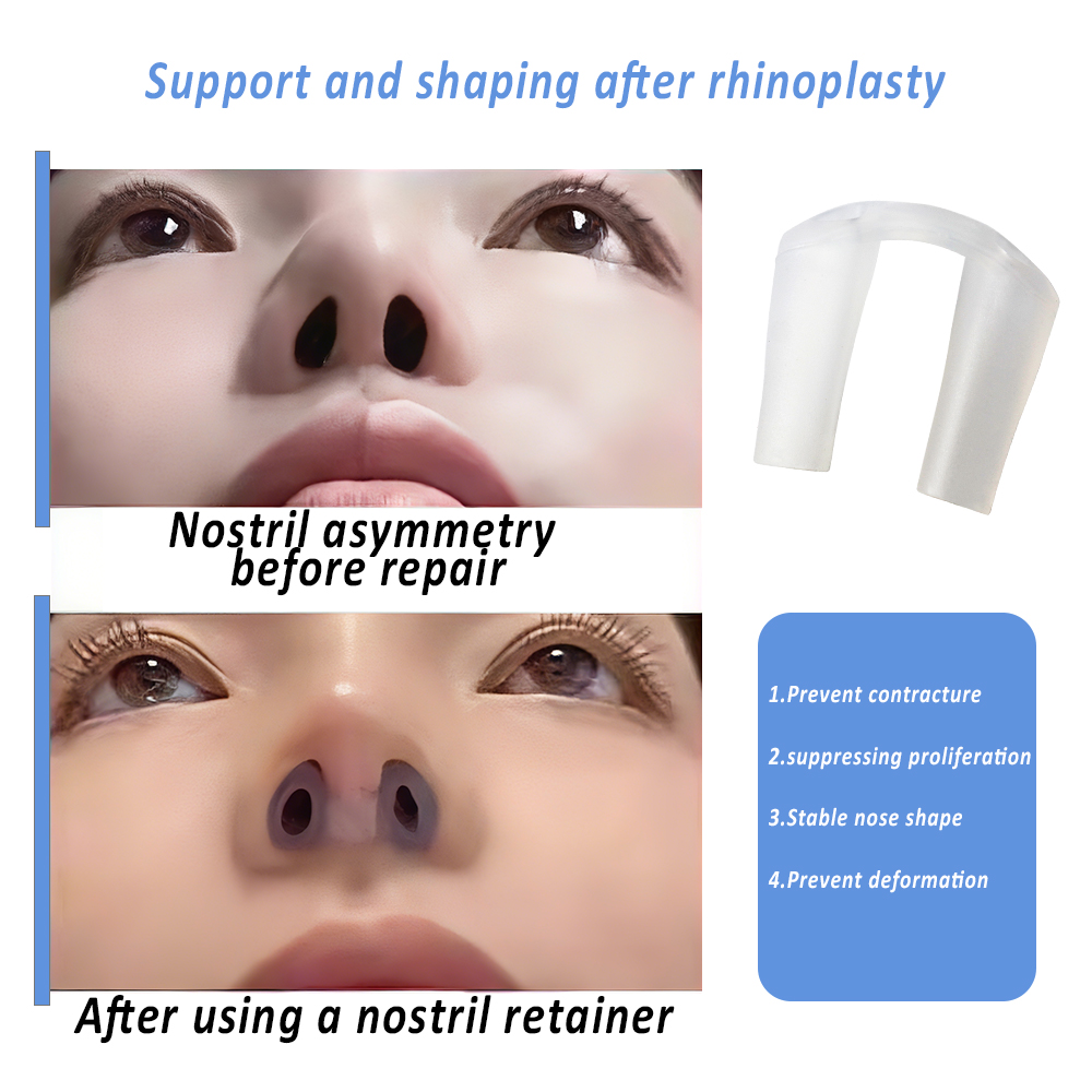Nostril Retainer For Post-Rhin - Anti Snore Contour Pillow 评论和价格